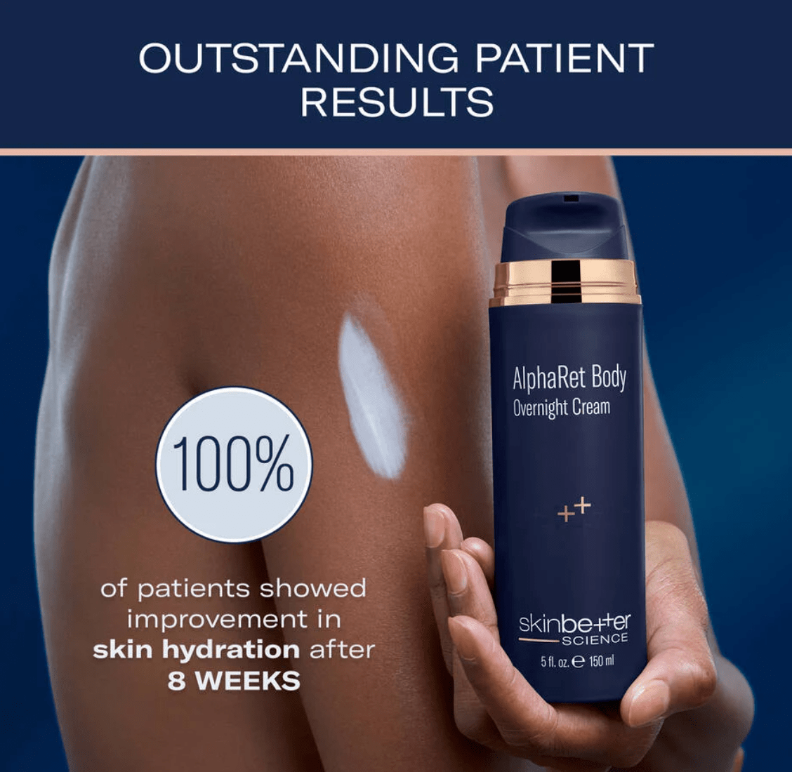 Skinbetter Science Alpharet Body- Overnight Cream