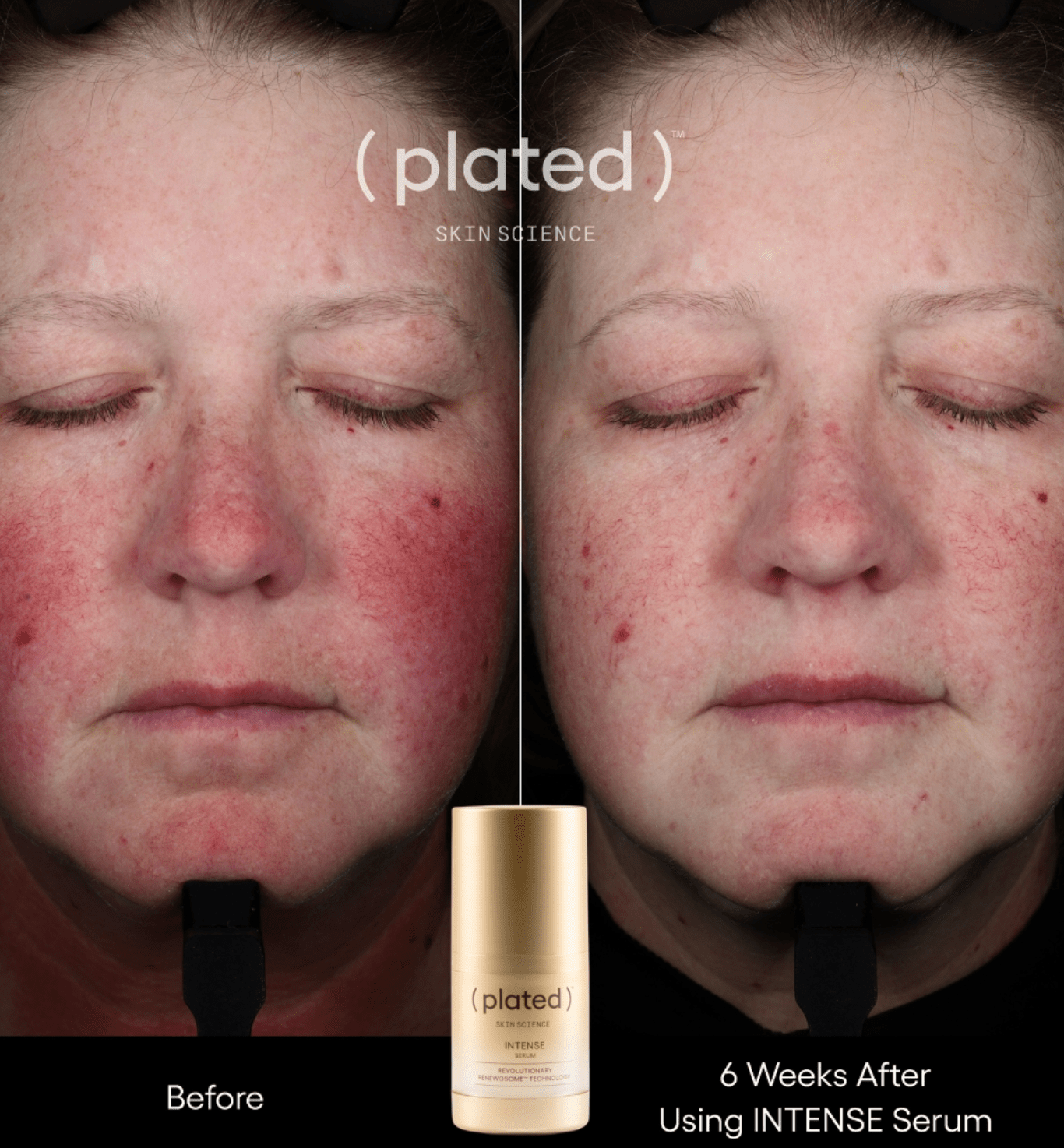 Plated Skin Science Intense Serum