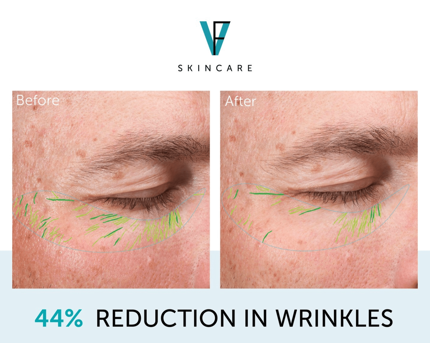 Factor Five Eye&Lash Cream