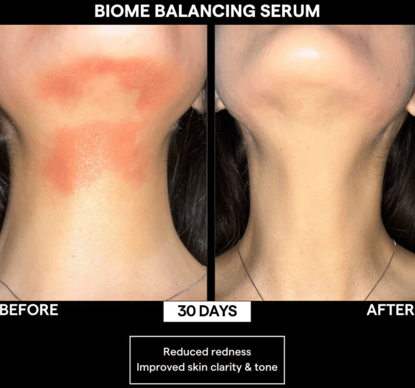 SIV Biome Balancing Serum