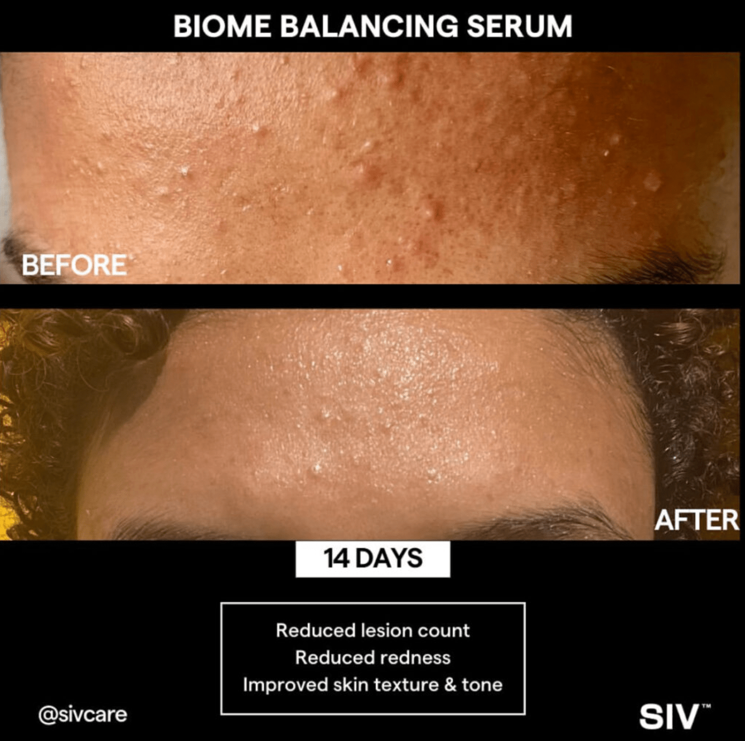 SIV Biome Balancing Serum