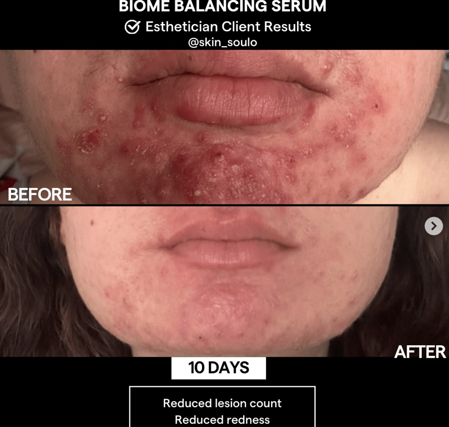 SIV Biome Balancing Serum