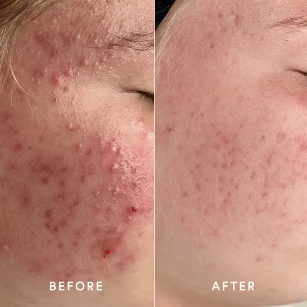 Epicutis Lipid Serum